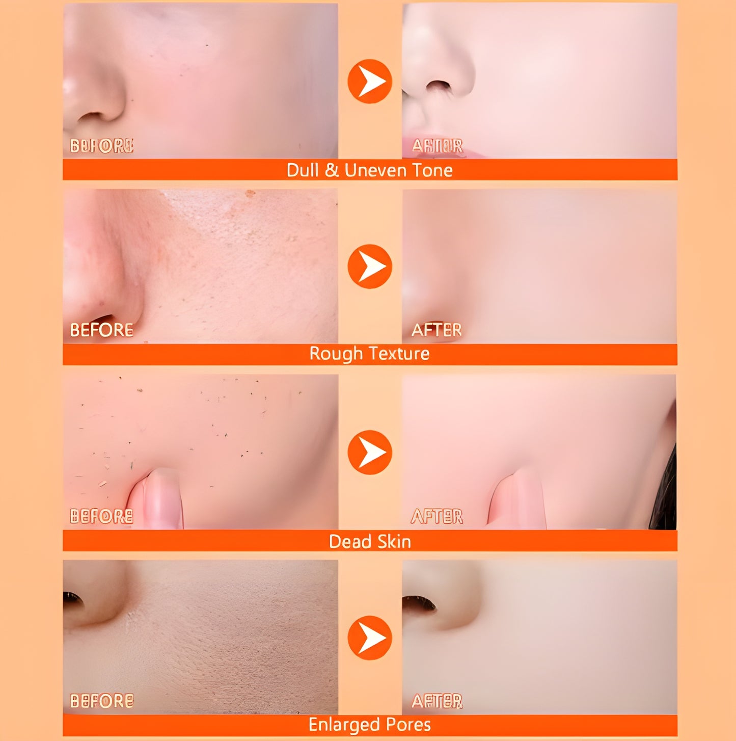 SoftTouch Peeling spray